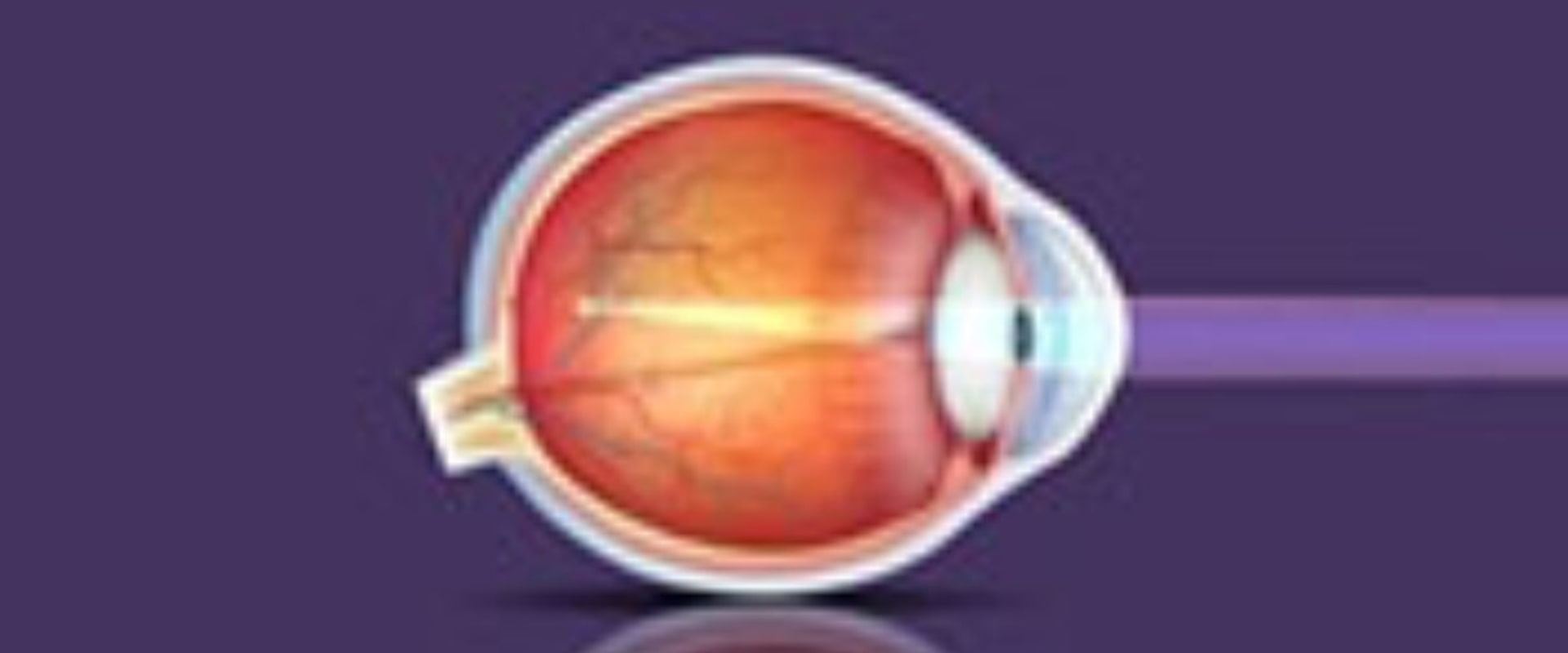 How LASIK Surgery Can Correct Myopia, Astigmatism and Farsightedness