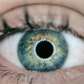 What are the Potential Risks of Laser Eye Surgery?