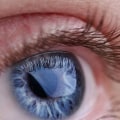 The Benefits and Risks of Laser Eye Surgery