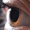 Is LASIK Worth It Financially? The Benefits and Risks of the Procedure