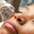 Can Dark Skin Be Treated with Laser Hair Removal?