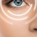 How to Ensure a Successful Recovery After Laser Eye Surgery
