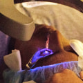 The Pros and Cons of Laser Eye Surgery