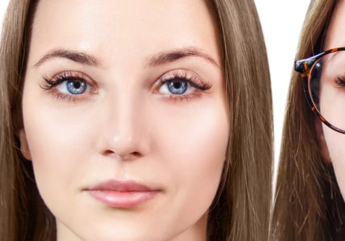 Is Laser Eye Surgery Worth It at 30?