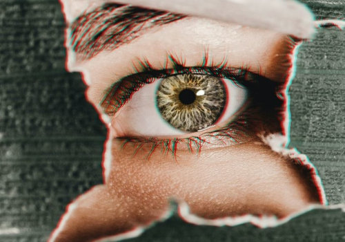 Can You Have Laser Eye Surgery with Lupus?