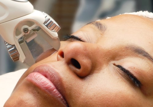 Can Dark Skin Be Treated with Laser Hair Removal?