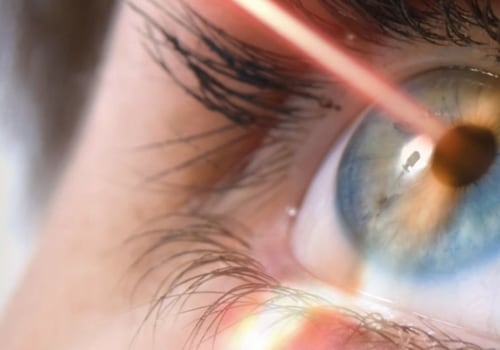 The Pros and Cons of Laser Eye Surgery