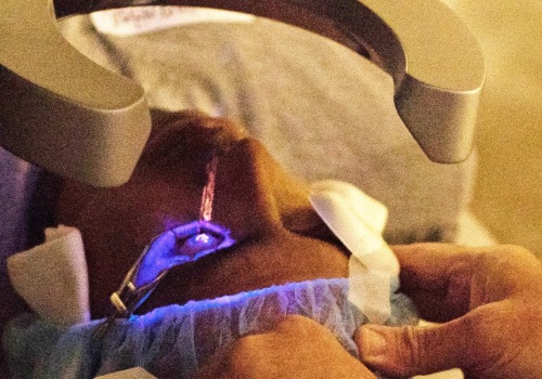 The Pros and Cons of Laser Eye Surgery