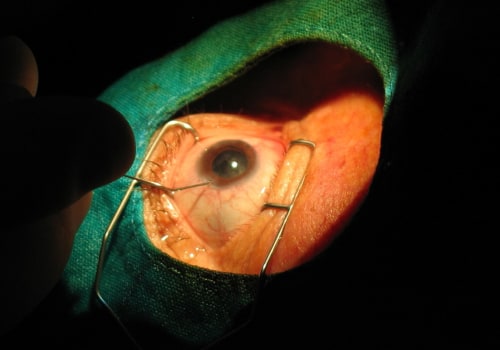 Is LASIK OK After 50?