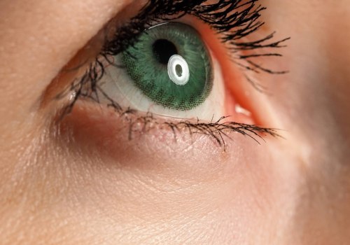Can You Have Laser Eye Surgery with Dry Eyes? Here's What You Need to Know