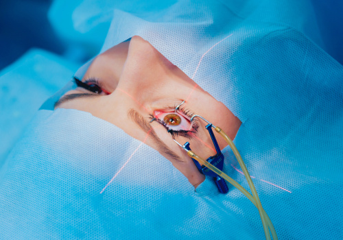What Precautions Should You Take After Laser Eye Surgery?